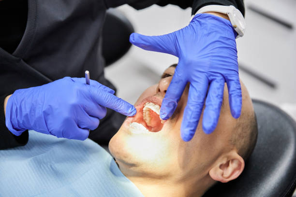 Best Knocked-Out Tooth (Avulsed Tooth) Treatment in Graymoor Devondale, KY